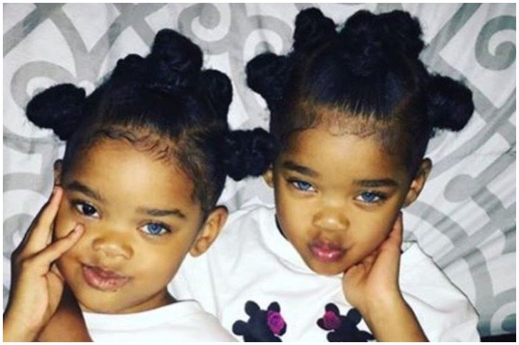 Blue Eyed Girls Who Became A Sensation And Are Called The Worlds Cutest Twins Page 2 Of 34 