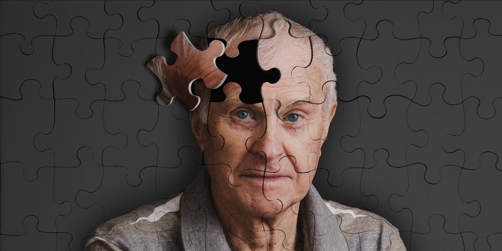 Alzheimer S Disease Everything You Need To Know Medical Matters