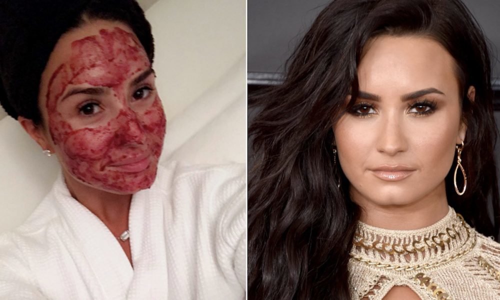 crazy-skin-care-treatments-beauty-routines-of-these-celebrities-will-shock-you